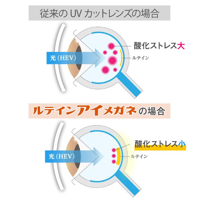 ルテインアイメガネだと酸化ストレスが少ない