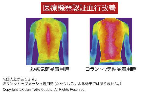 医療機器認定血行改善