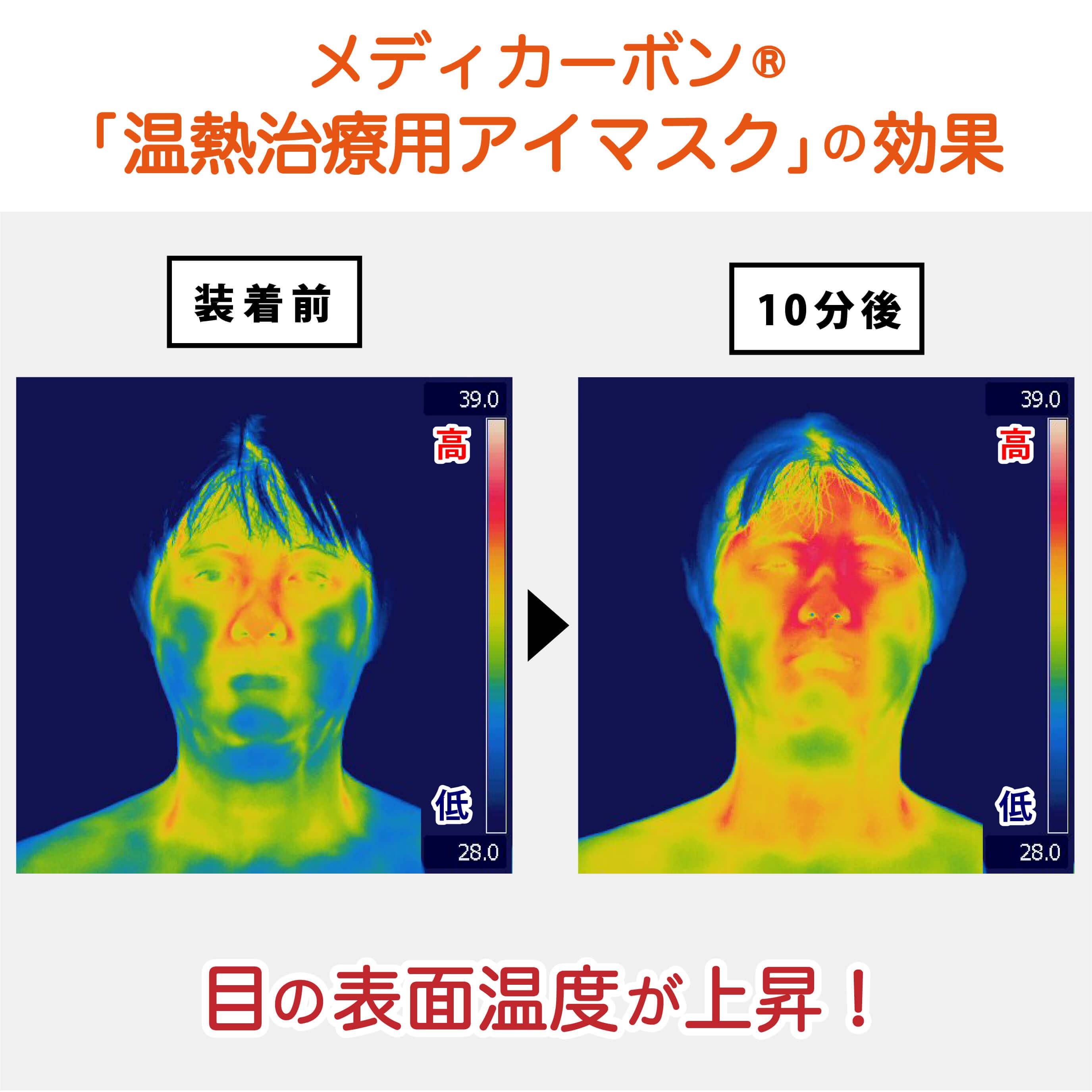 メディカーボン温熱治療用アイマスクの効果の研究結果画像