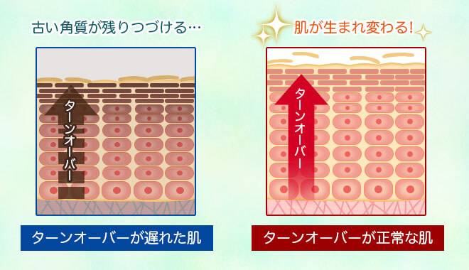 ターンオーバーが遅れた肌とターンオーバーが正常な肌の図