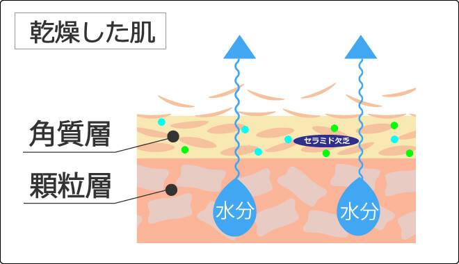 乾燥した肌の状態を説明する画像